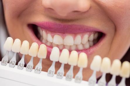 Имплантация зубов с привлекательной скидкой доступна нижегородцам